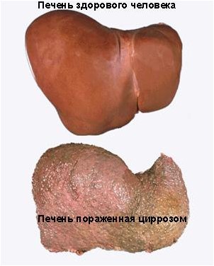 влияние влияние
